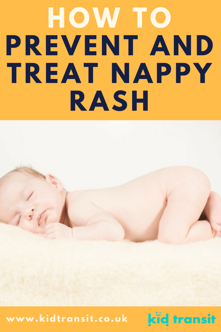 How to prevent and treat nappy rash on your baby